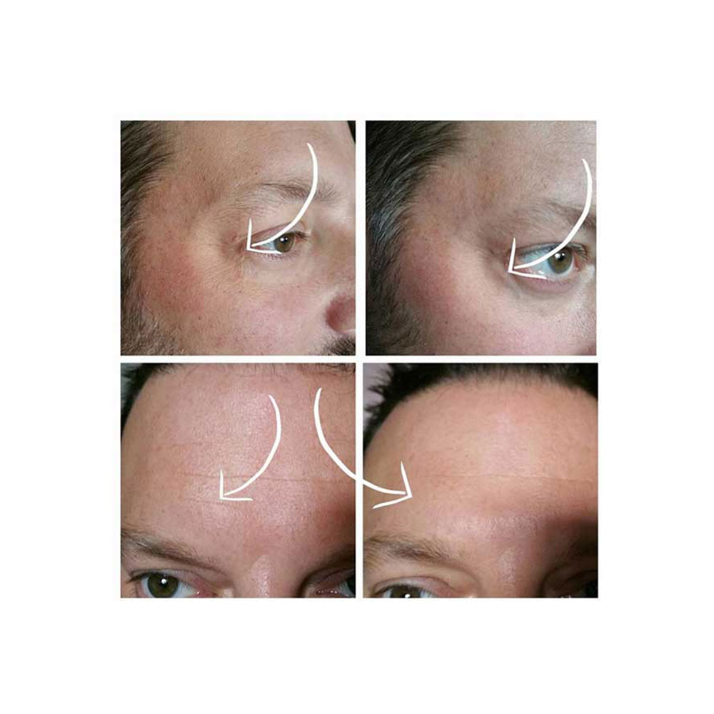 سرم ضد چروک و لیفت فوری Dragons Blood بالانس Balance